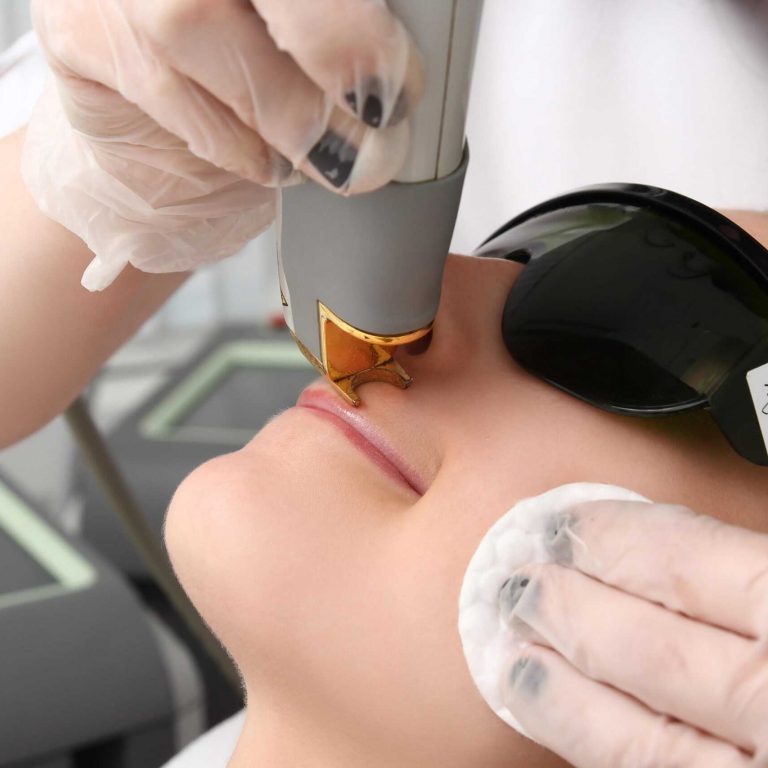 Laser Hair Removal inside