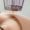 Micro Needling inside